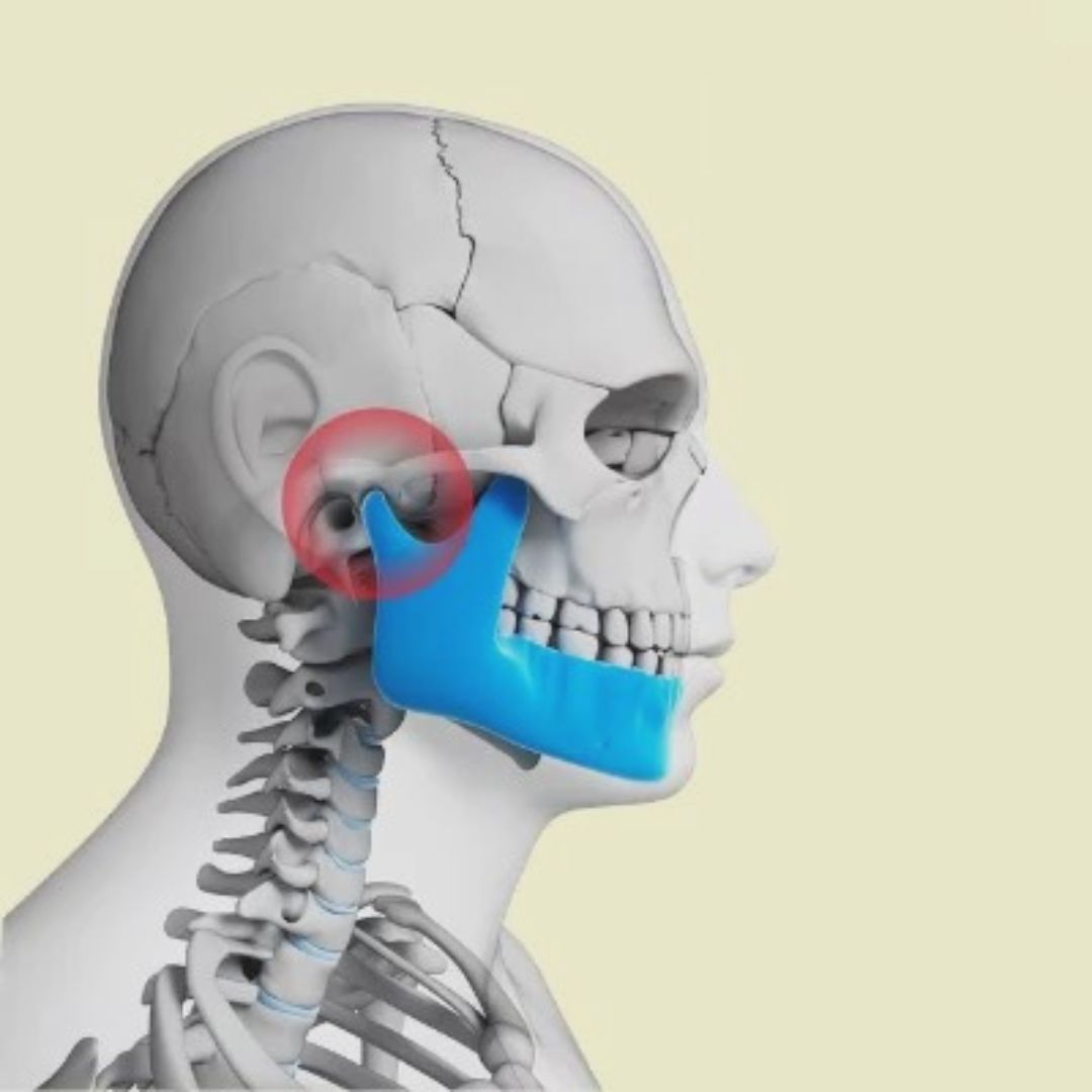 TMJ Disorder Treatment